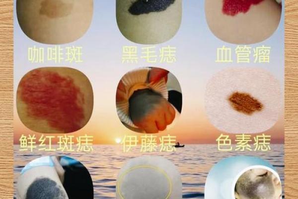 看胎记颜色类型算命