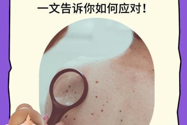 女人背部痣相图解算命