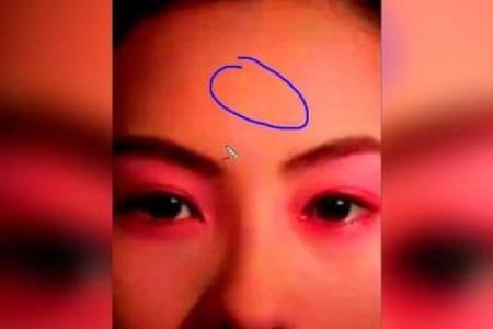 知命运，脸上胎记算命什么说法