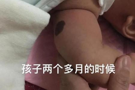 胳膊胎记可以算命吗-
