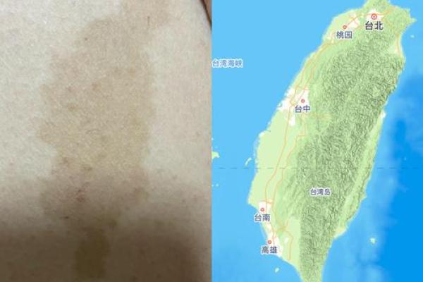 身体上的胎记位置不同算命分析