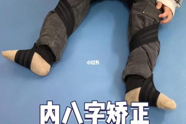 什么是内八字