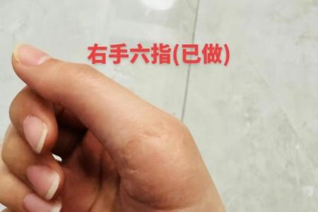 算命如何说六指