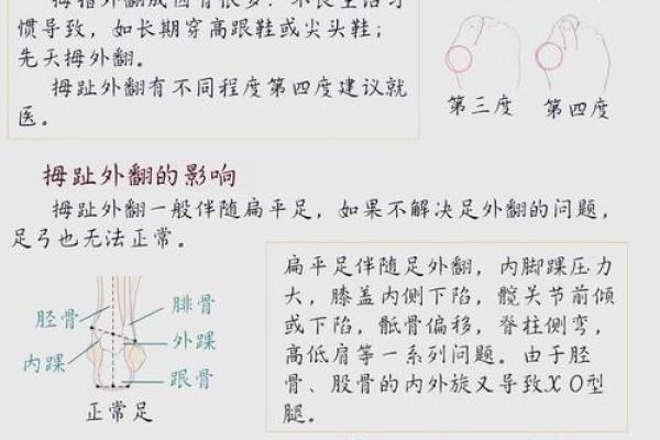 如何矫正外八字