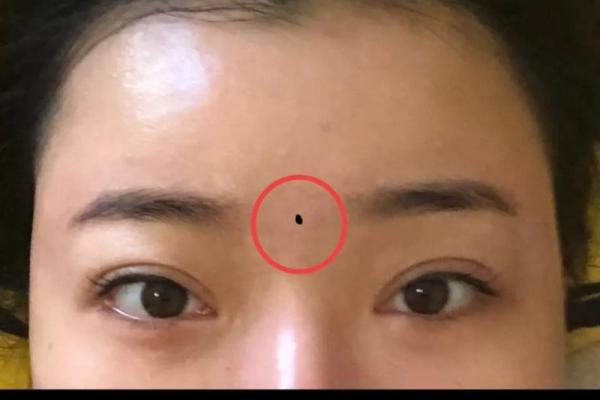 印堂痣和观音痣的区别,观音痣是大富大贵的代表