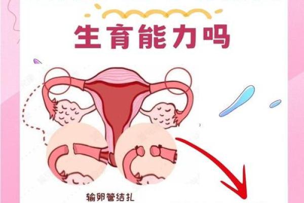八字结扎