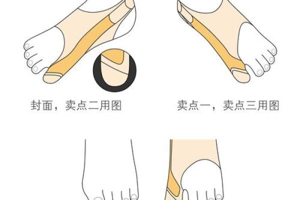 外八字纠正