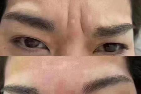 印堂八字纹的男人爱老婆吗